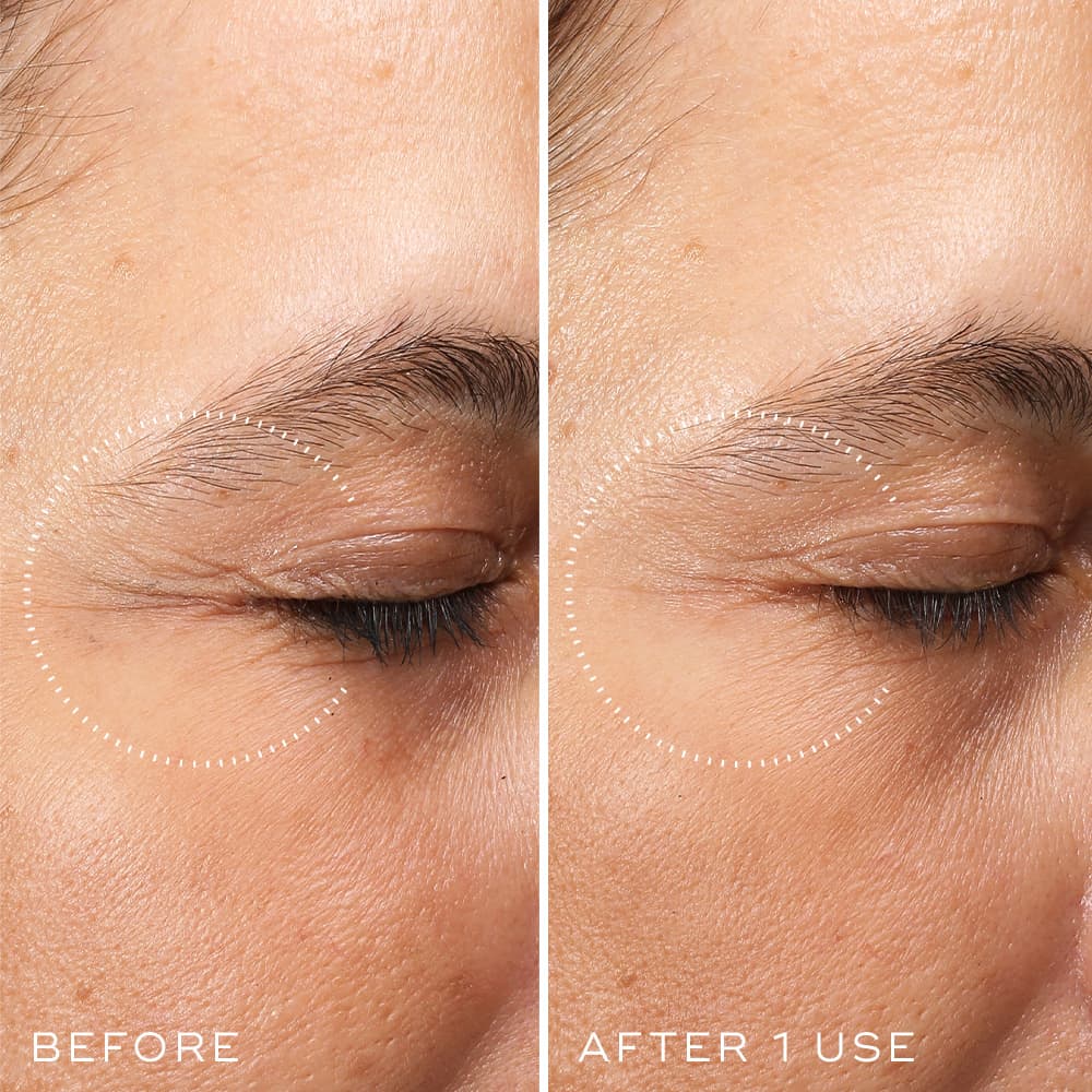 MEDIK8 CRYSTAL RETINAL CERAMIDE EYE 3