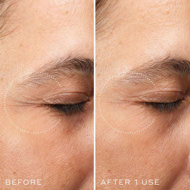 MEDIK8 CRYSTAL RETINAL CERAMIDE EYE 3