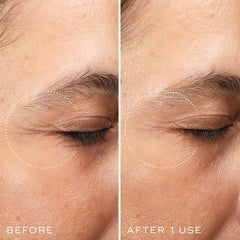 MEDIK8 CRYSTAL RETINAL CERAMIDE EYE 3