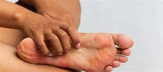 SVR XERIAL 50 Anti-callosidades 50ml